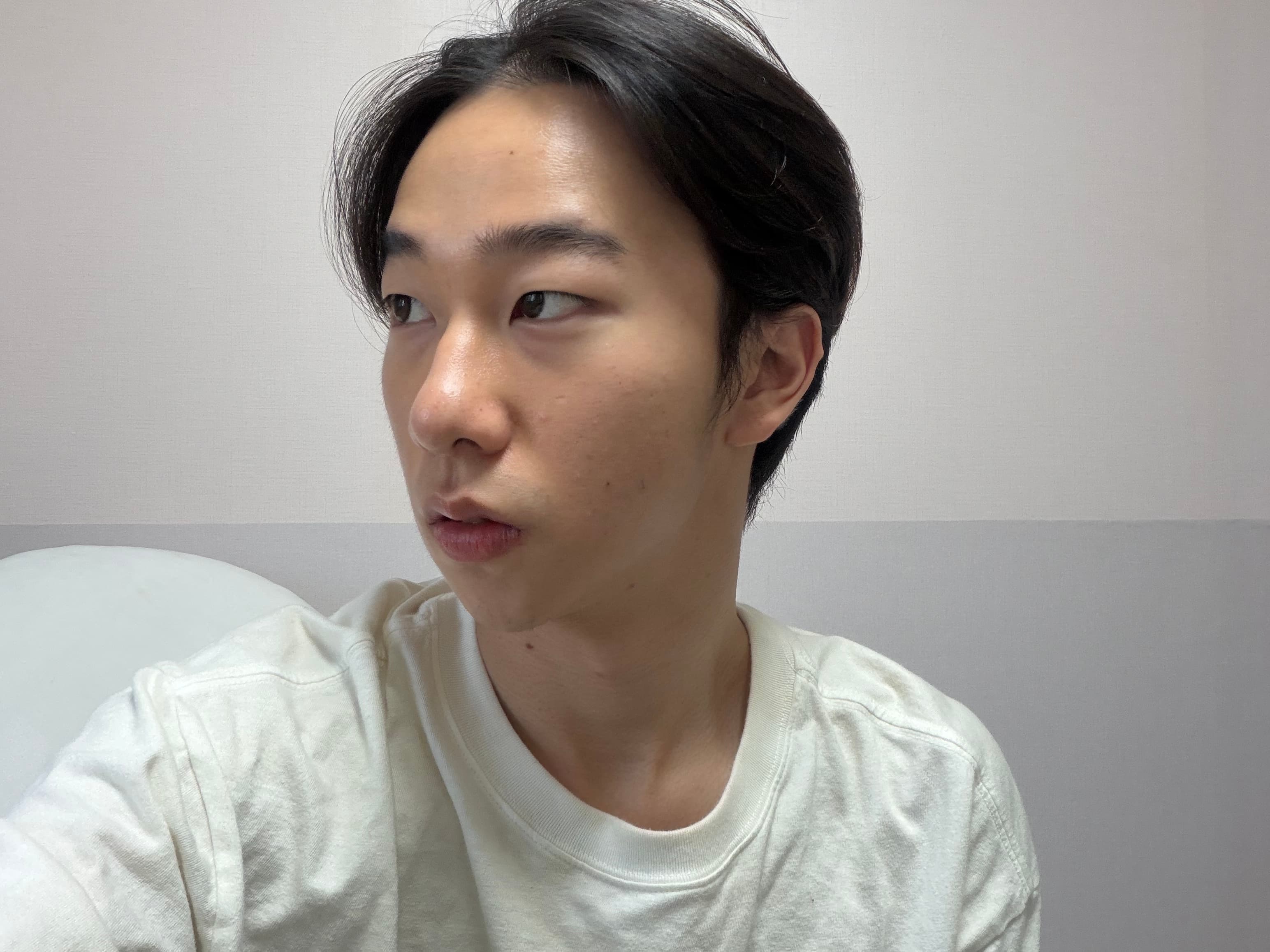 우우닏님의 시술후기