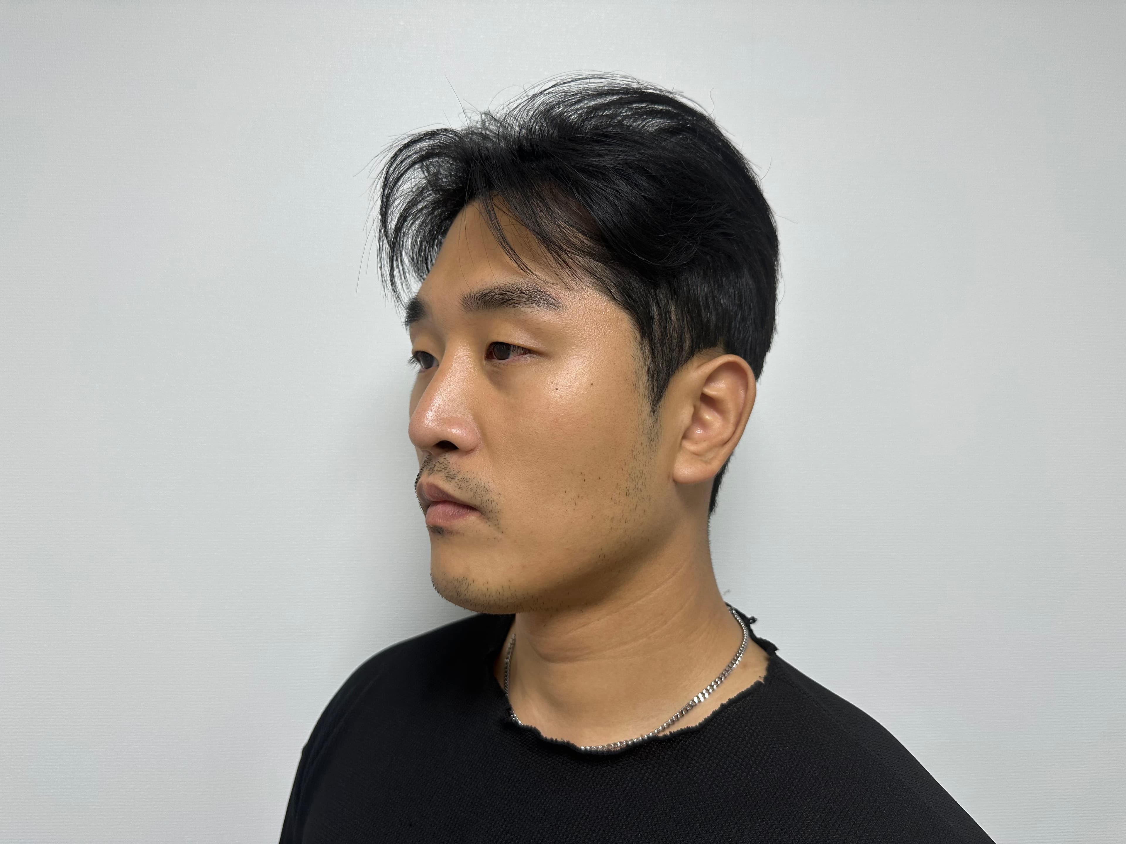 은은항님의 시술후기