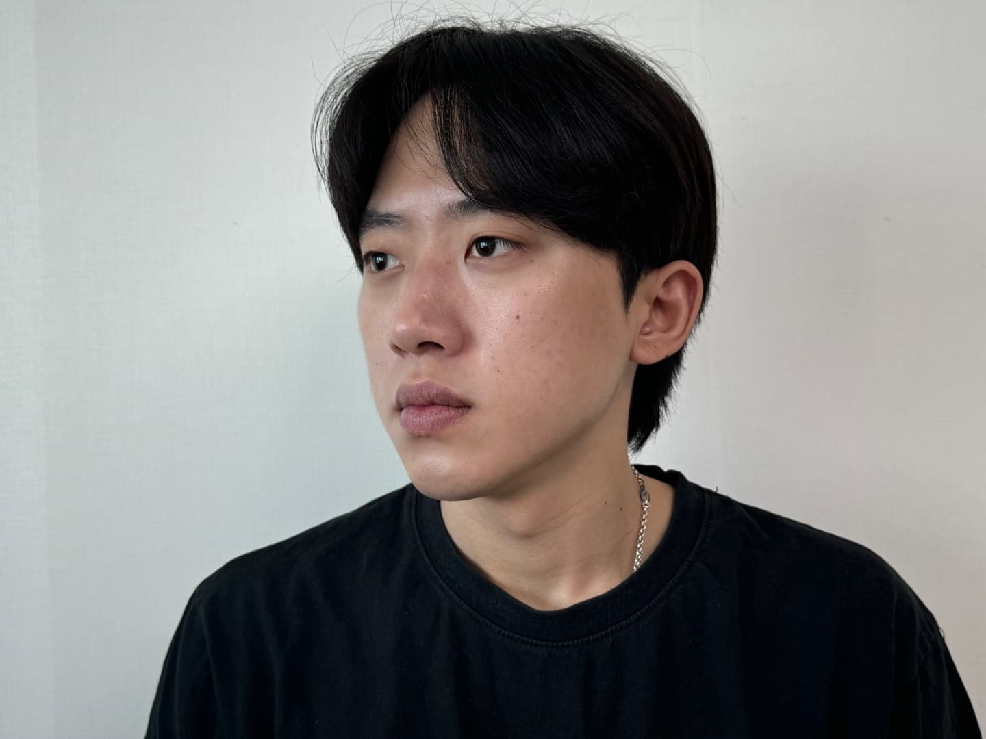 주뉴님의 시술후기