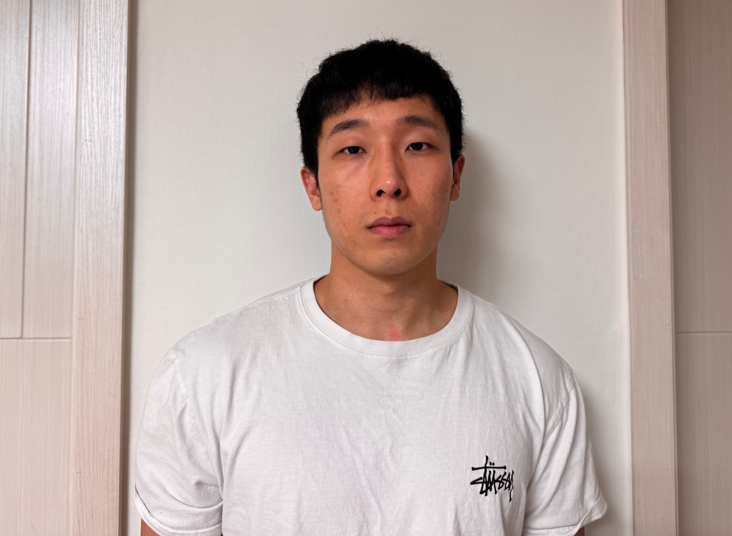 ennwjhh님의 시술후기