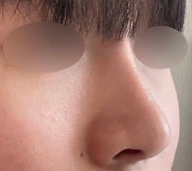 K4937040811님의 시술후기