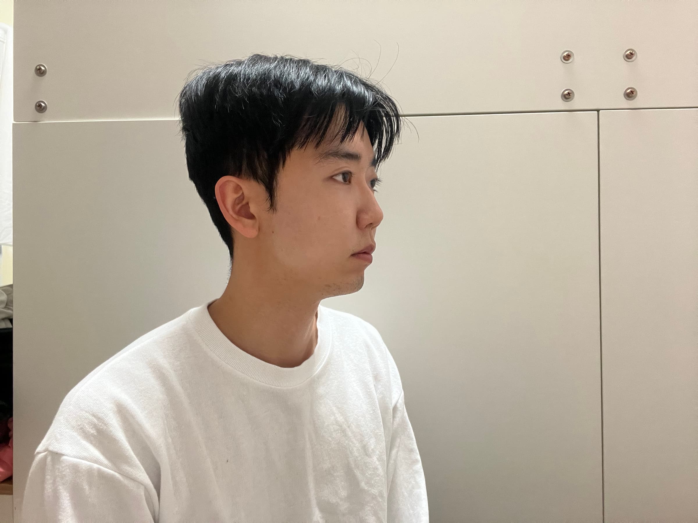 공어르님의 시술후기