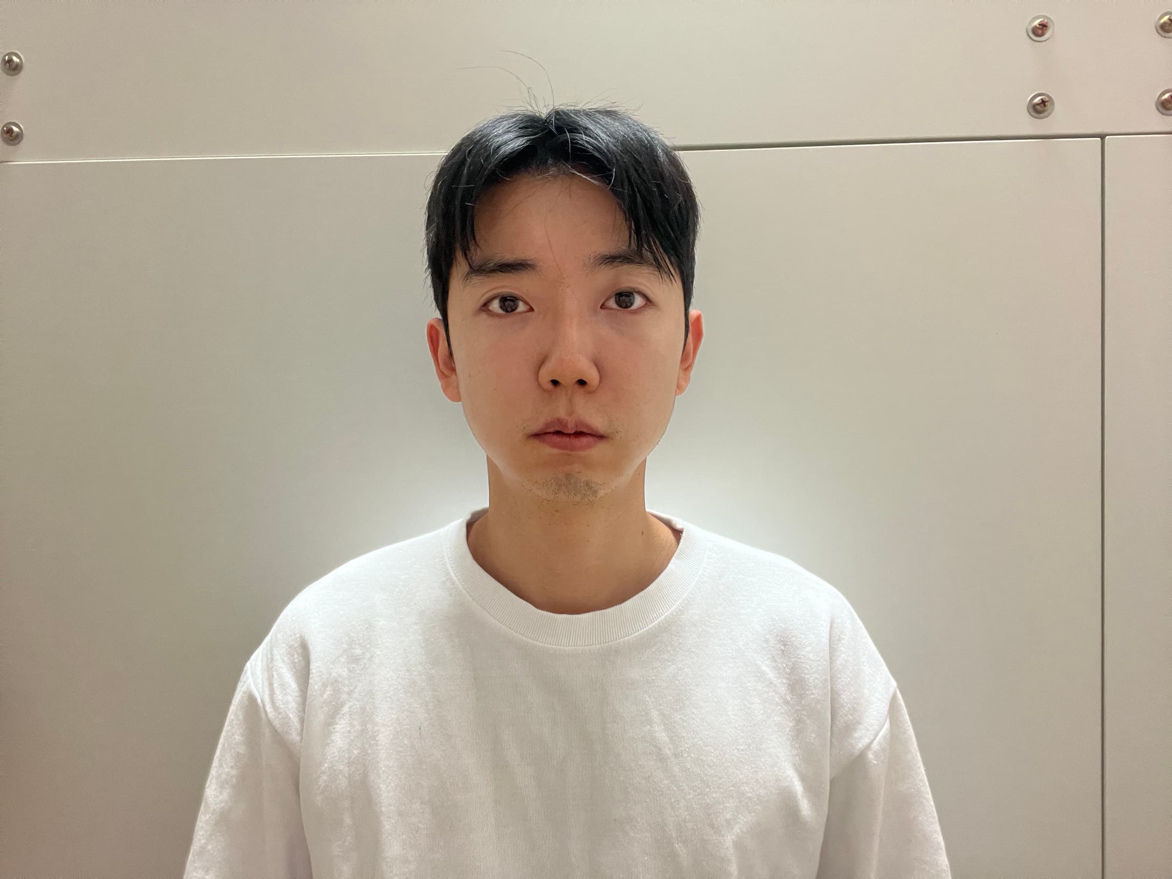 공어르님의 시술후기