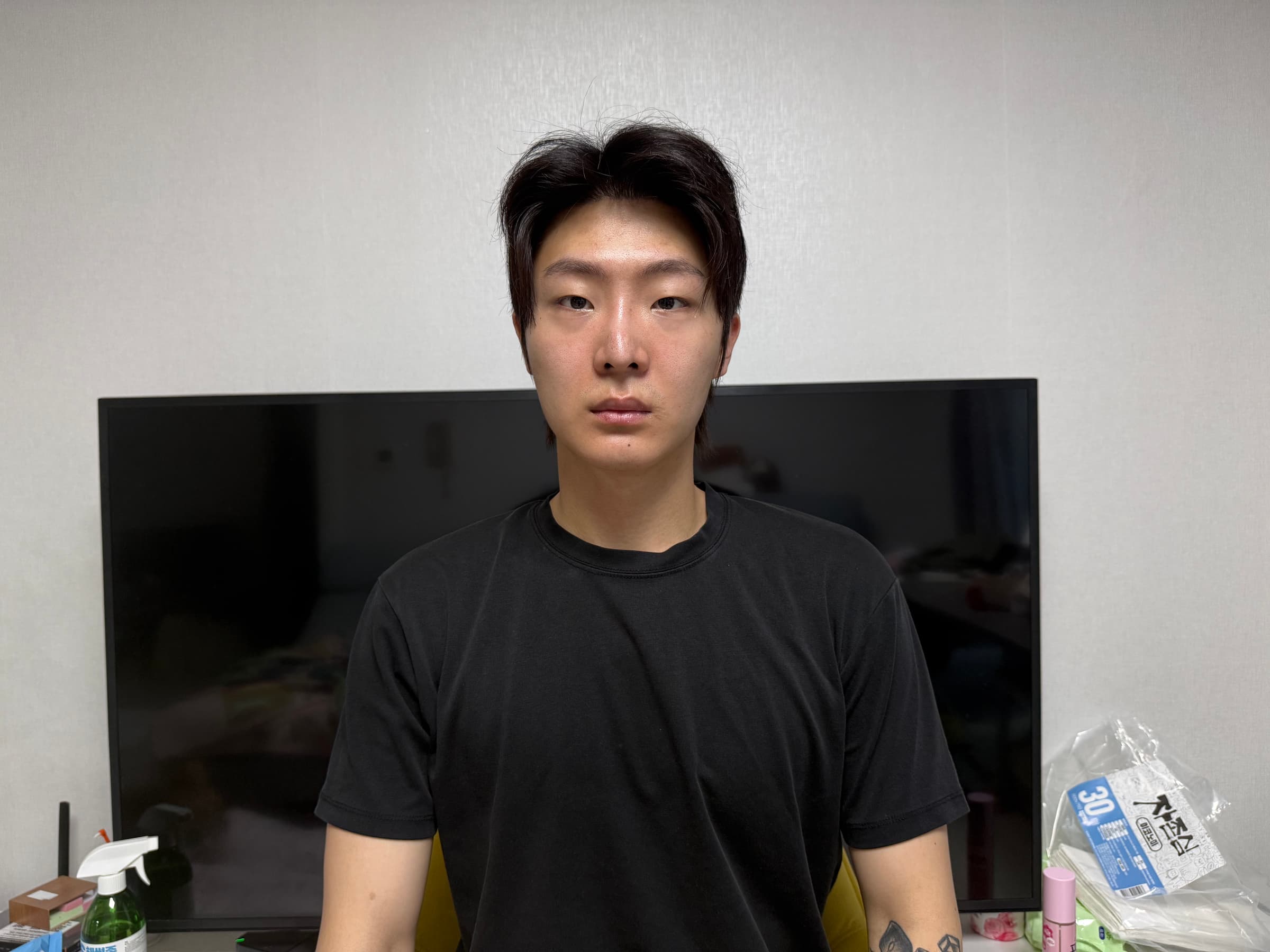 율비추님의 시술후기