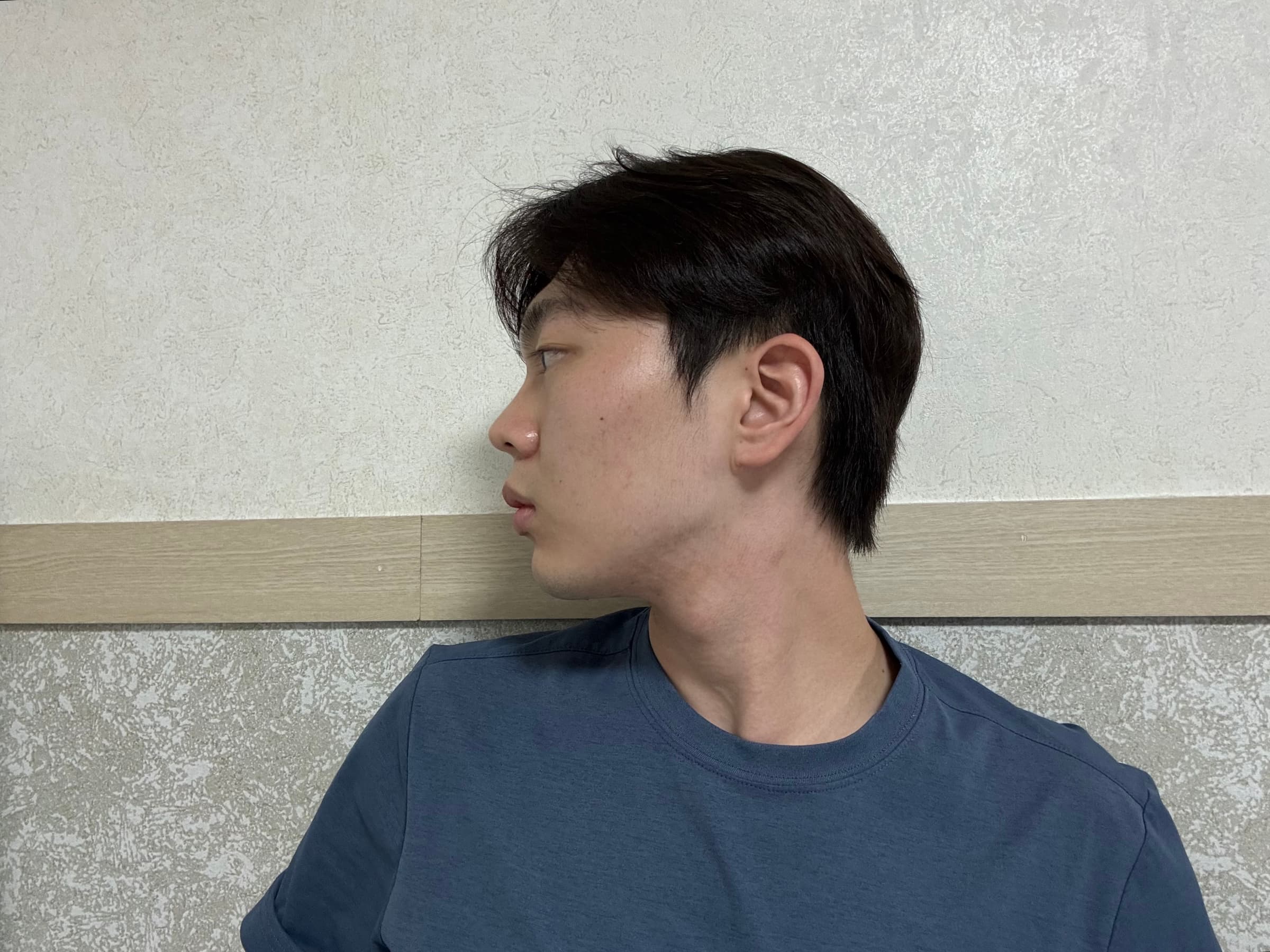 칠팔구장이님의 시술후기