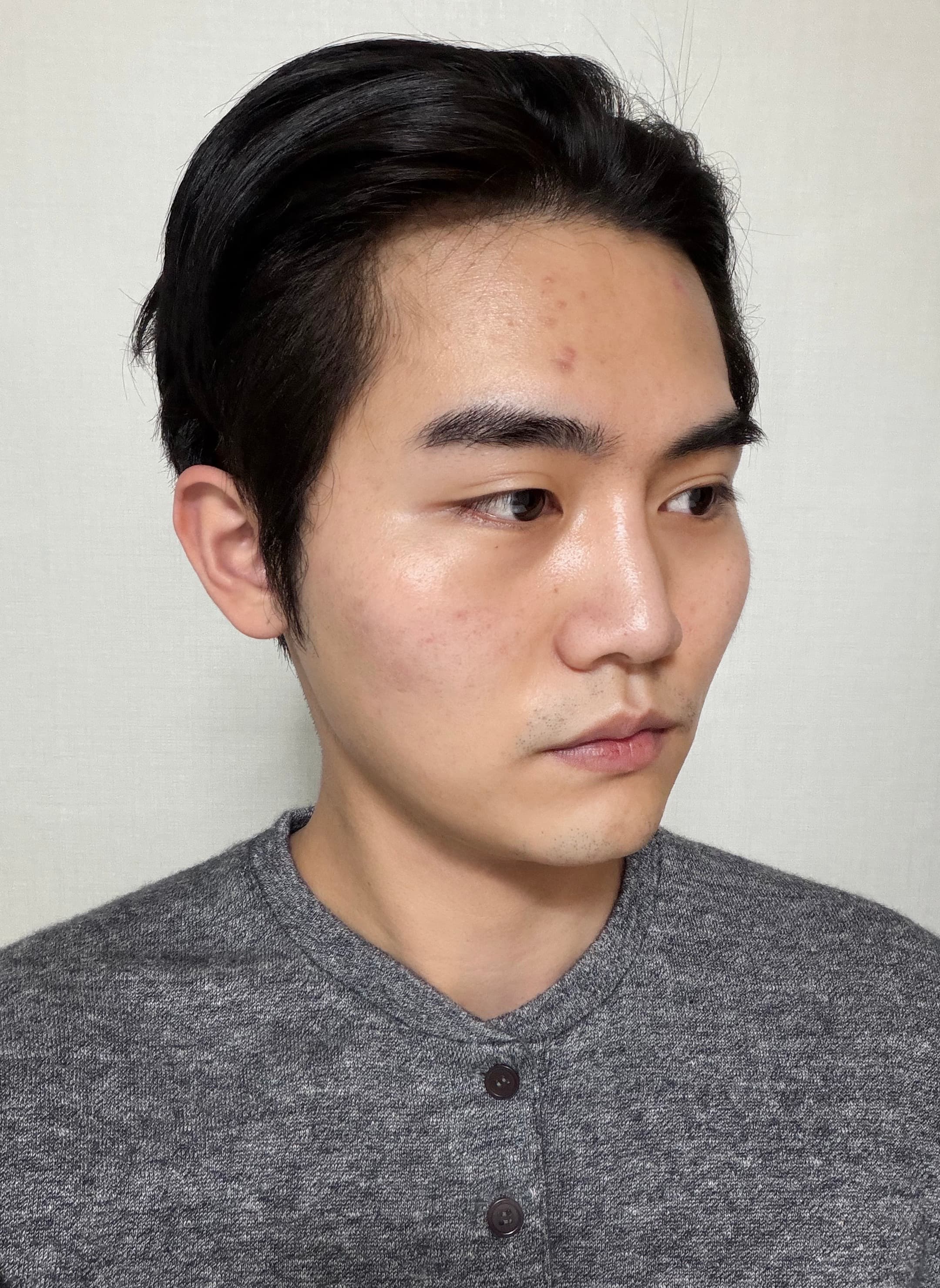 쿠리두차님의 시술후기