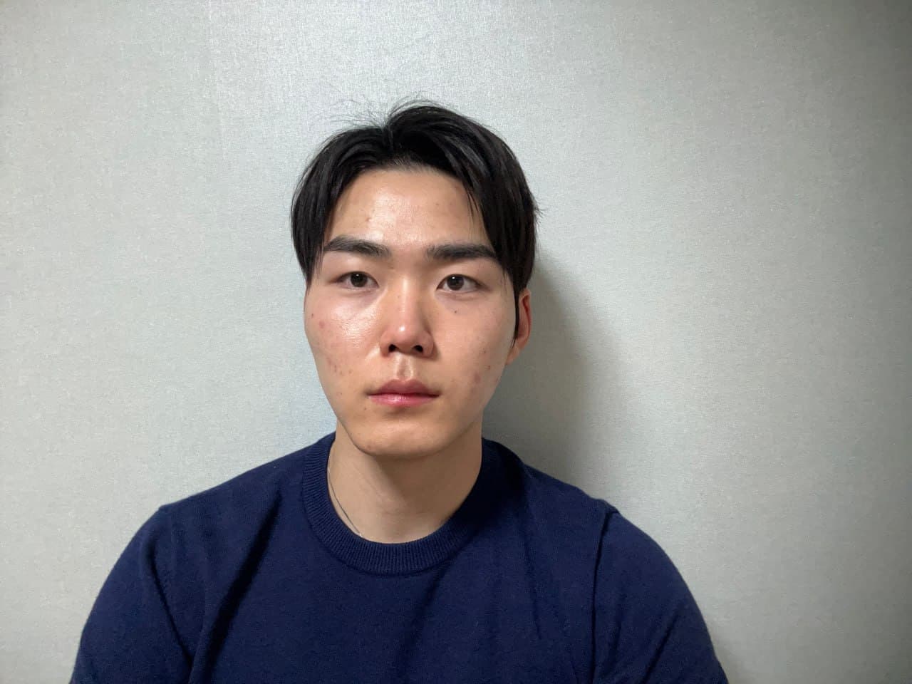 나나랠님의 시술후기