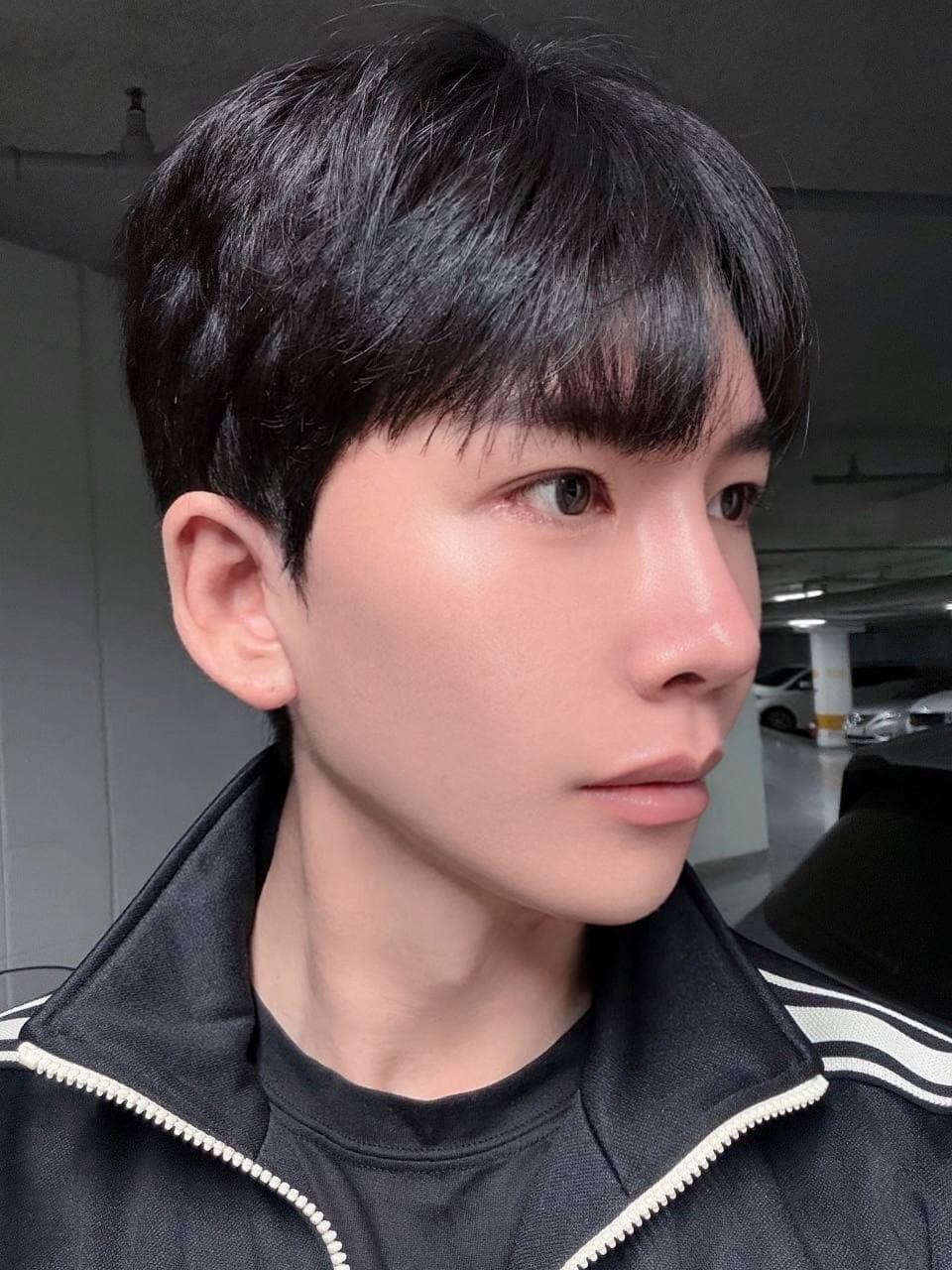 EYDNgj님의 시술후기