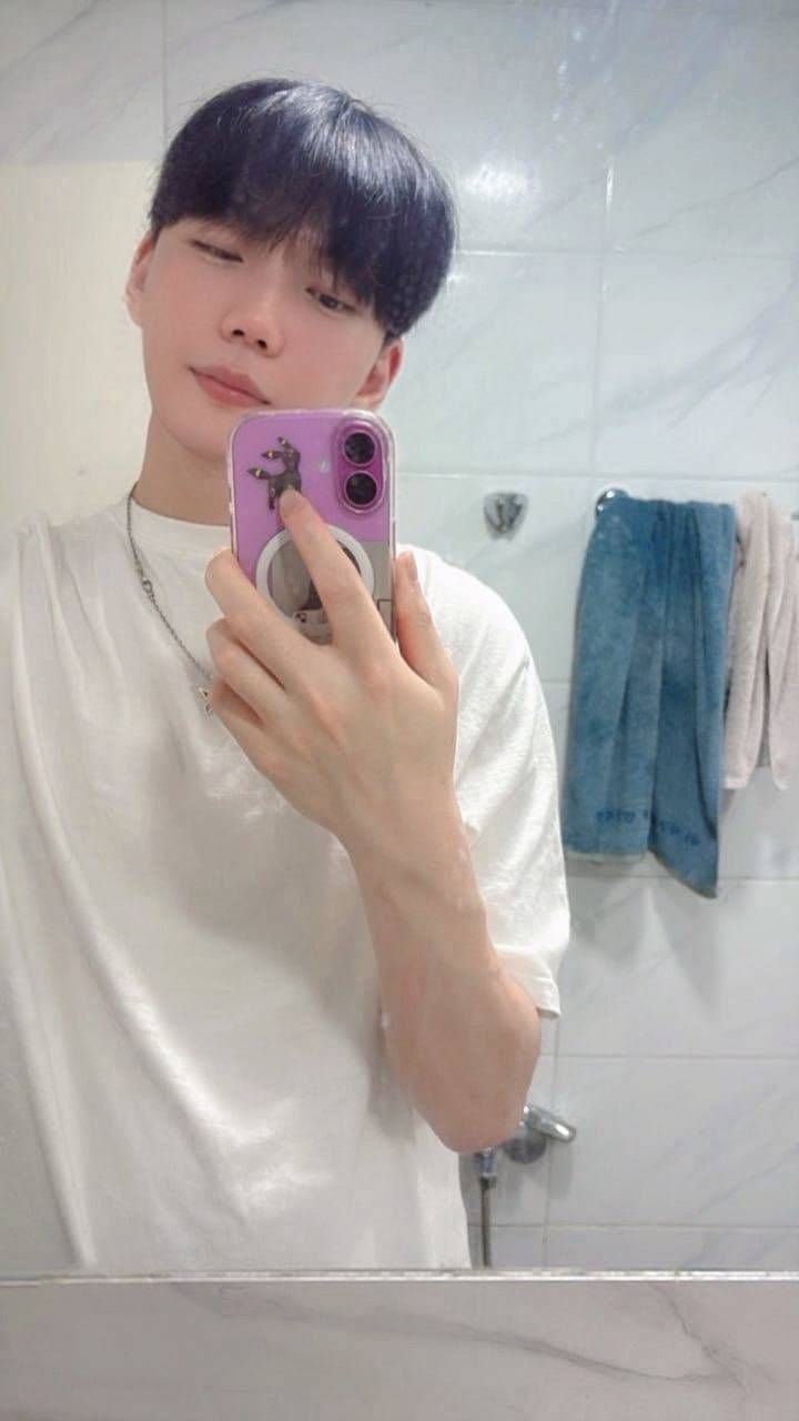 이브븡님의 시술후기