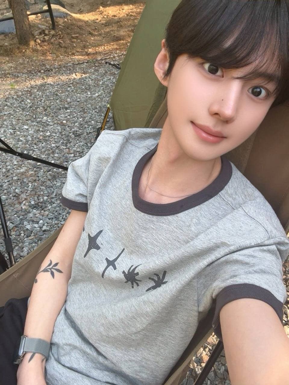 크리쑤님의 시술후기