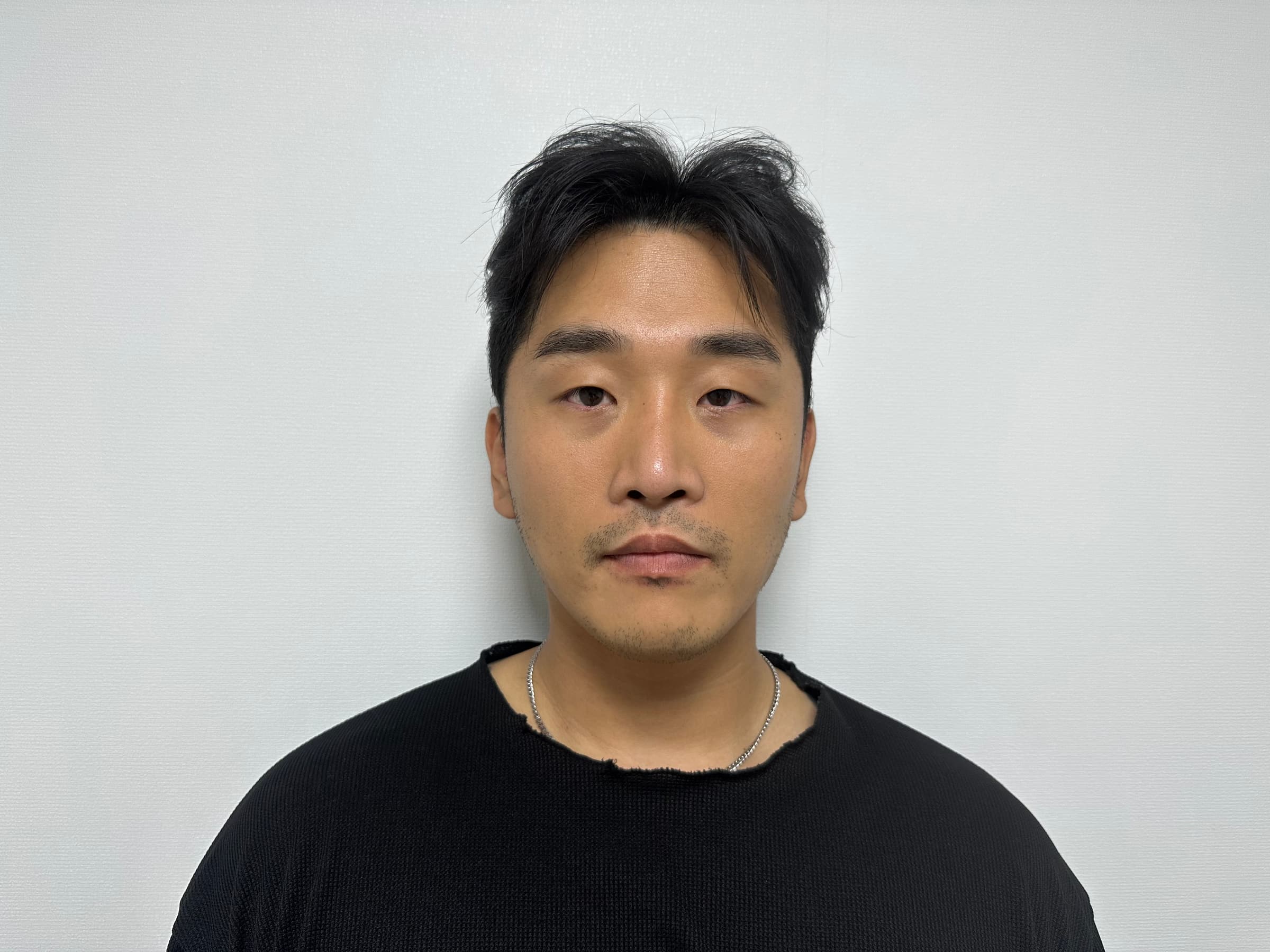 은은항님의 시술후기