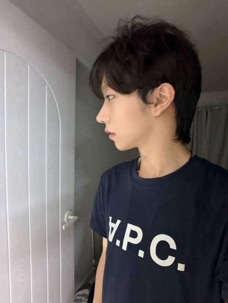 우우닏님의 시술후기