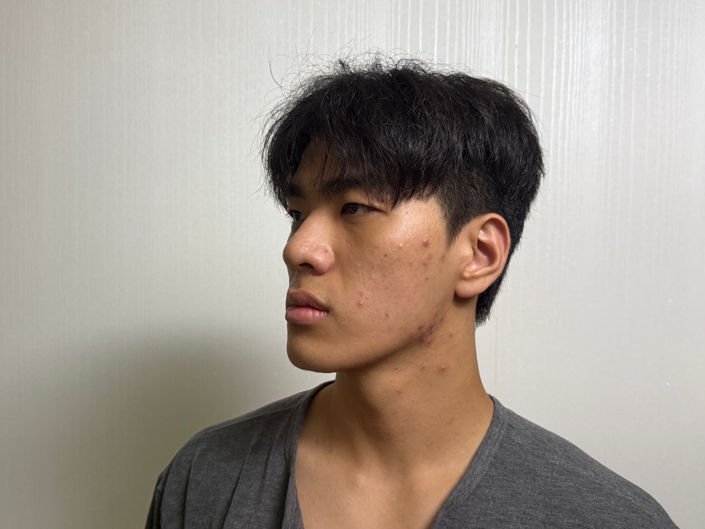 바다먼징님의 시술후기