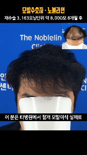 ee32a82a014bd5a186c0245a041788b9_1729746453_9344.gif ee32a82a014bd5a186c0245a041788b9_1729746453_9344.gif