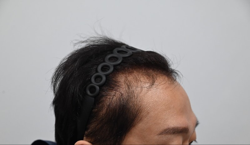 e57e056e214d517aa1d083b4e767529b_1736858252_0376.jpg e57e056e214d517aa1d083b4e767529b_1736858252_0376.jpg