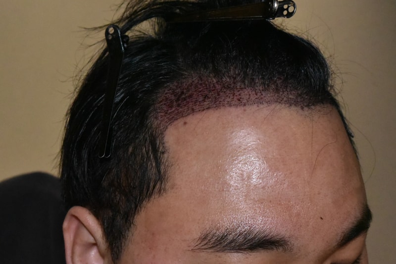 ac9b9e0a200e79bfb7d97b2dcf53fc87_1738582746_8913.jpg