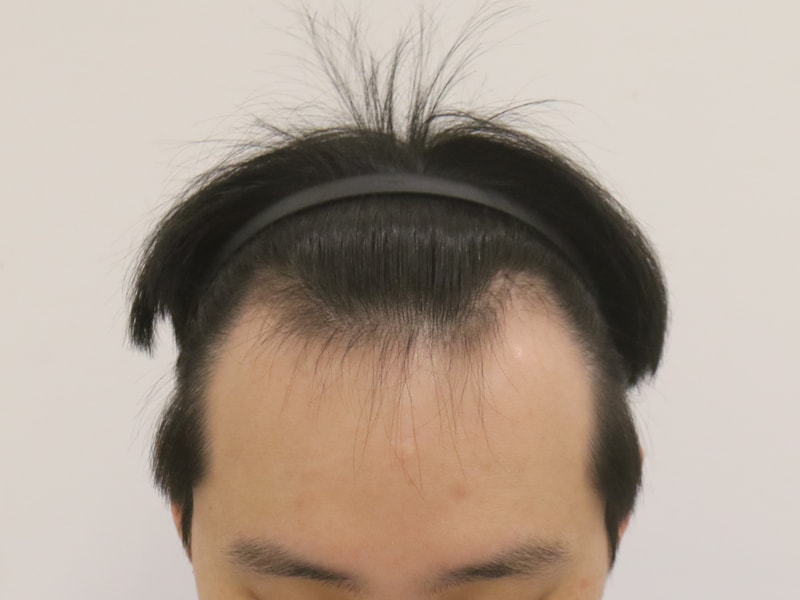 ff6c586c3ec947fc53084c61f9d82537_1739196595_2456.jpg ff6c586c3ec947fc53084c61f9d82537_1739196595_2456.jpg