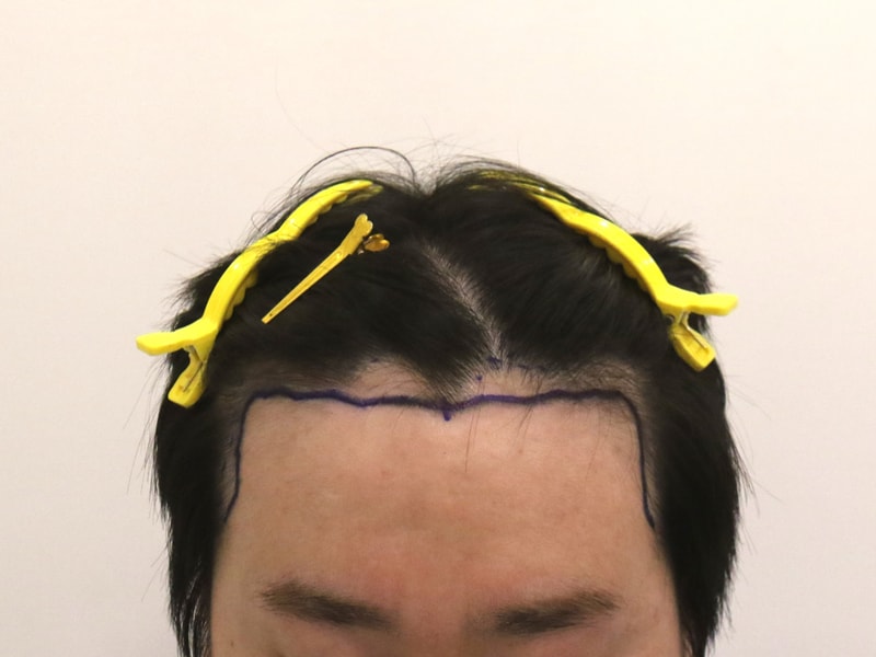 ec5b5e6d3e90346188fa5ef12f965b1b_1744614254_7398.jpg