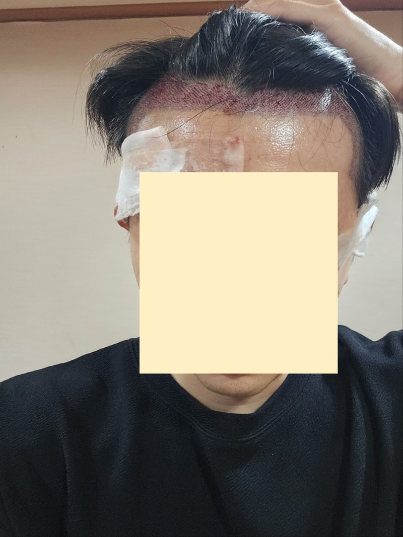 Post-mortem on the day of the surgery