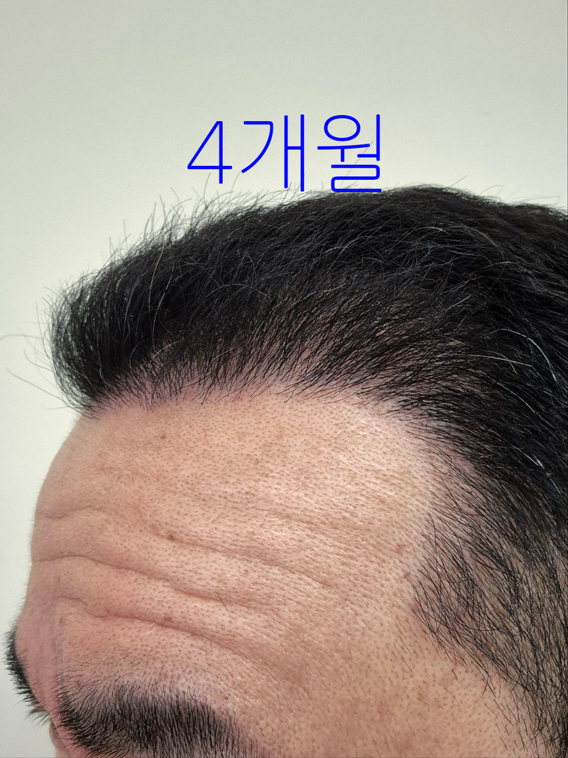 572e0125f0f5bdcb50df170476e96bd1_1751505321_5795.png