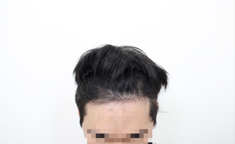 61e07aa6b0ecc1e6f907366614846d15_1752971840_877.jpg 61e07aa6b0ecc1e6f907366614846d15_1752971840_877.jpg