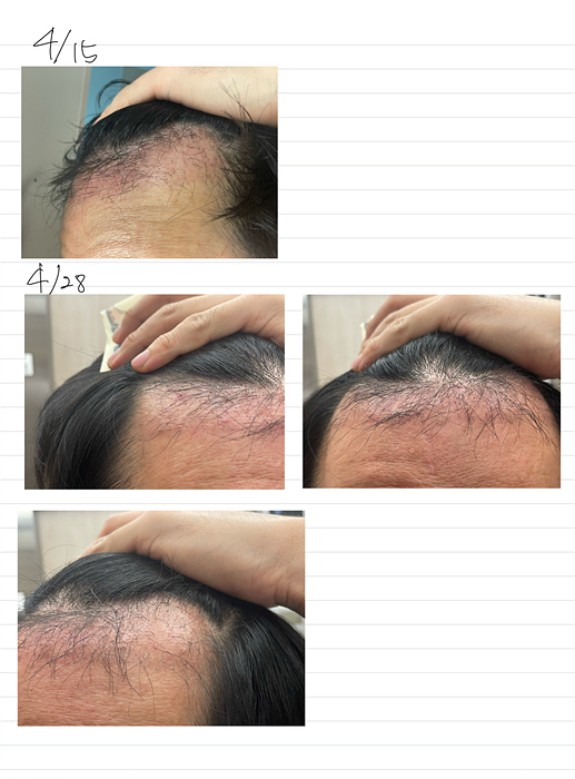 a5e0199413e463aa2b09f184c4728f5f_1754637836_7023.jpg a5e0199413e463aa2b09f184c4728f5f_1754637836_7023.jpg