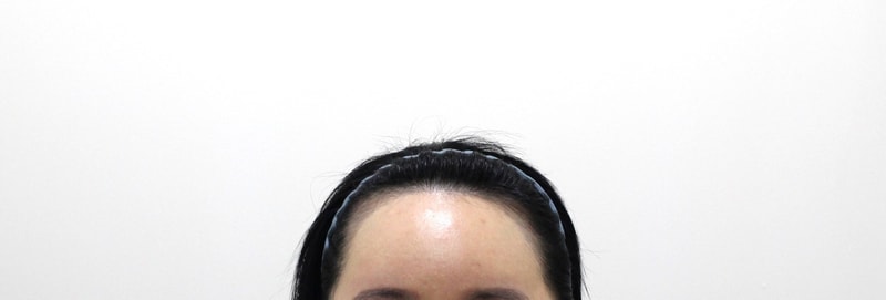 ★ Rep. Mopro, Hairline Correction + Day 10 of Gouretnaru! ★