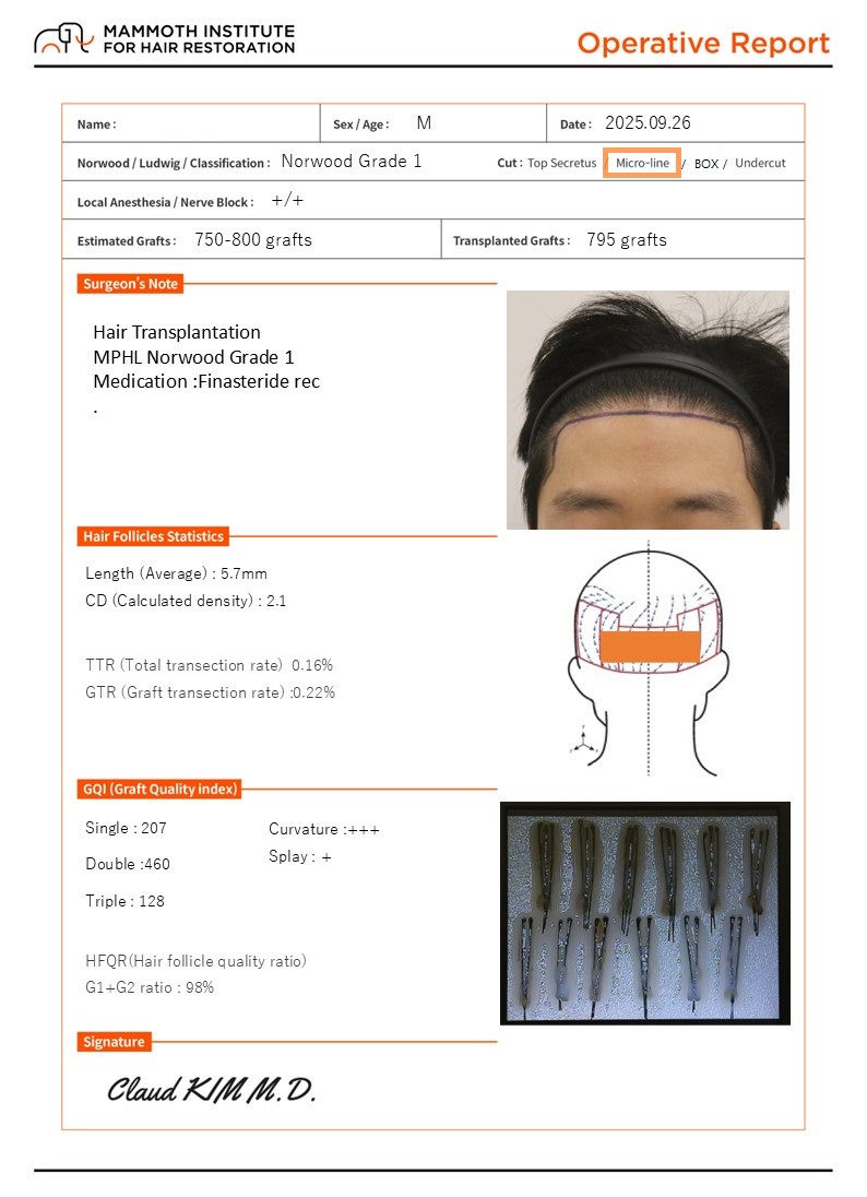 Busan Hair Transplantation Slit-type Mammoth Hair Restoration Center M Reoperation Day Review