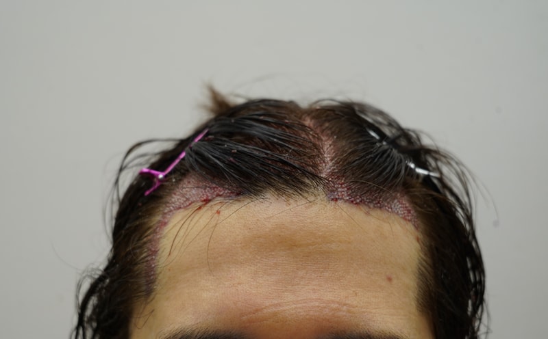 8aabcaccf5e8deb770e32e5a0c73ff9c_1764223014_6175.jpg
