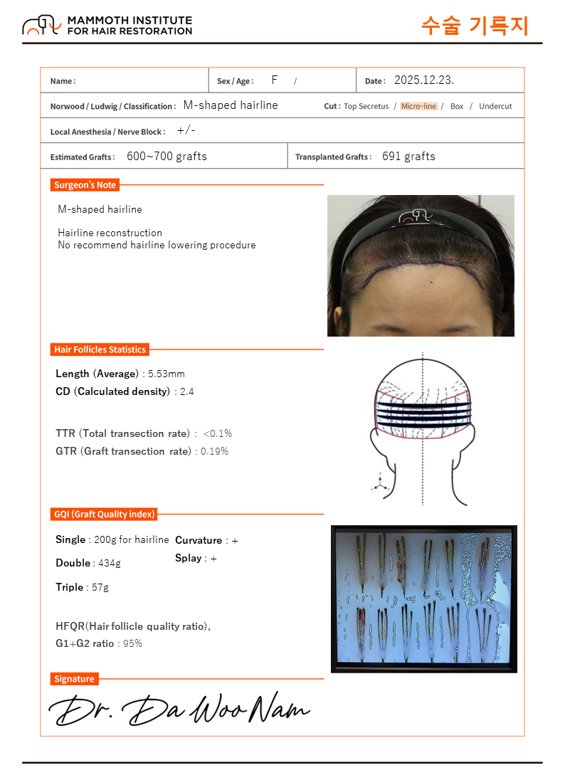압구정 맘모스 비절개 모발이식 후기
