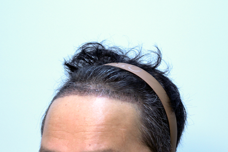 8823e5a03c2c3af2bb599492e4c00095_1767084757_0279.jpg