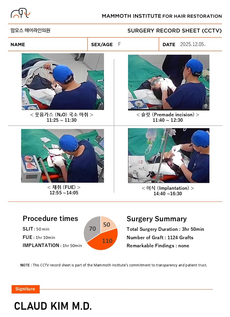 Day 1 Review of Hairline Correction in Busan Hair Transplantation Slit Method Mammoth Hair Restoration Center