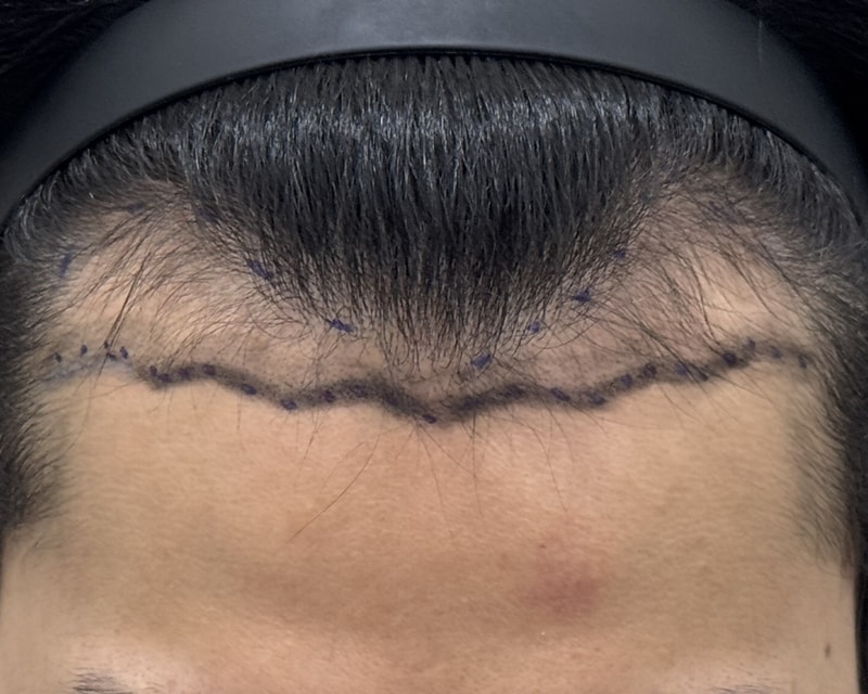 It's been 2 weeks~Yong Doctor (Doctor Park Sang-hyun) Non-cut 2400 Mo