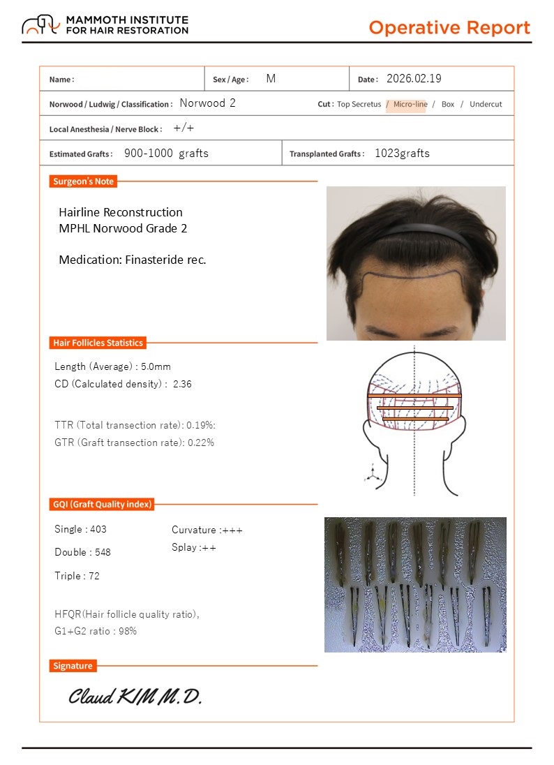 Busan Mammoth Hairline Non-Cutting Slit M-Shaped Hair Transplant Day Review