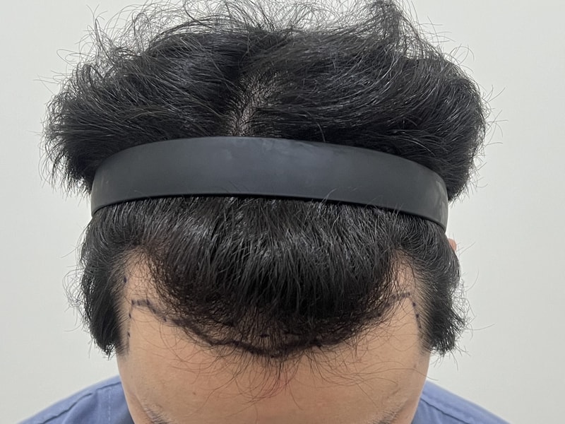 용닥터 박상현원장님한테 2800모 받았습니다.