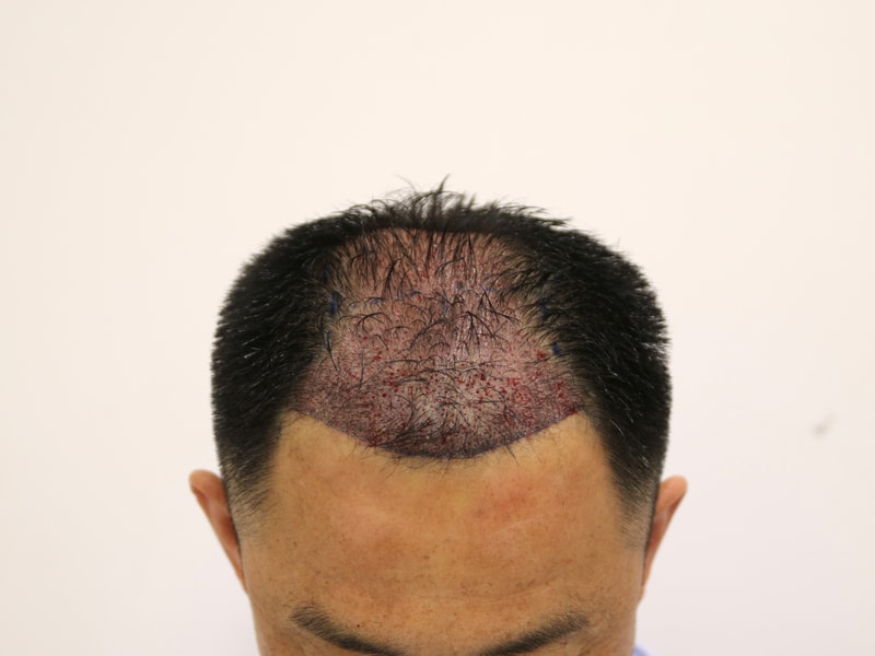 8602e006498864339023bec7b6976a5d_1774524661_1912.jpg 8602e006498864339023bec7b6976a5d_1774524661_1912.jpg