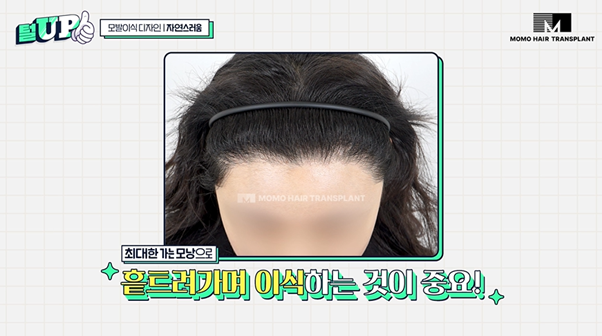 8ce89019e2b503309e2adf346bc6d2ae_1772603909_5236.png