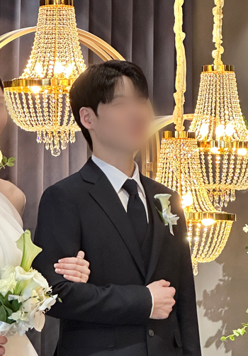 [Review] Review of the first year of non-cutaneous Hair Transplant in MOEM Clinic!
