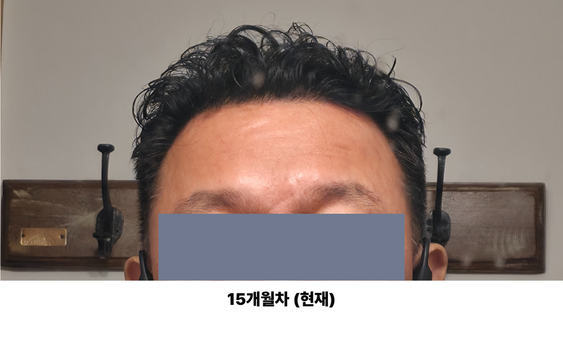 9e502e4a3507f28b0603351c50e02bfa_1773199614_7625.png