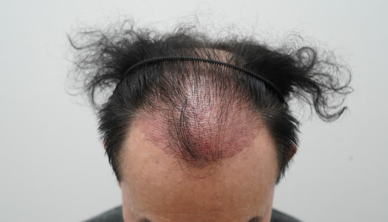 b53b493a9c8d64198cdd27b6125702e0_1773722108_7163.JPG