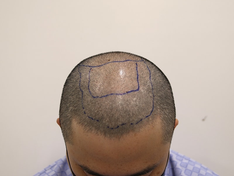 850bfeef15b5e8f0b7529659ffad261f_1775727115_3363.jpg