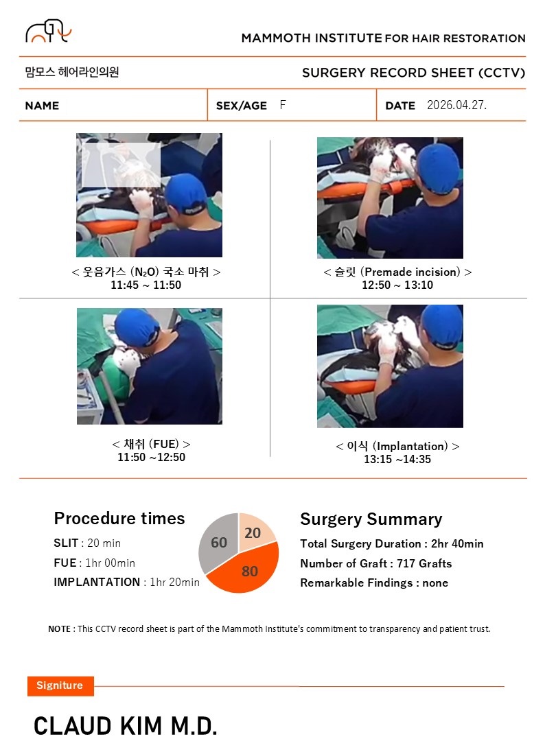 부산맘모스 비절개 정수리(가르마) 모발이식 수술 당일 후기