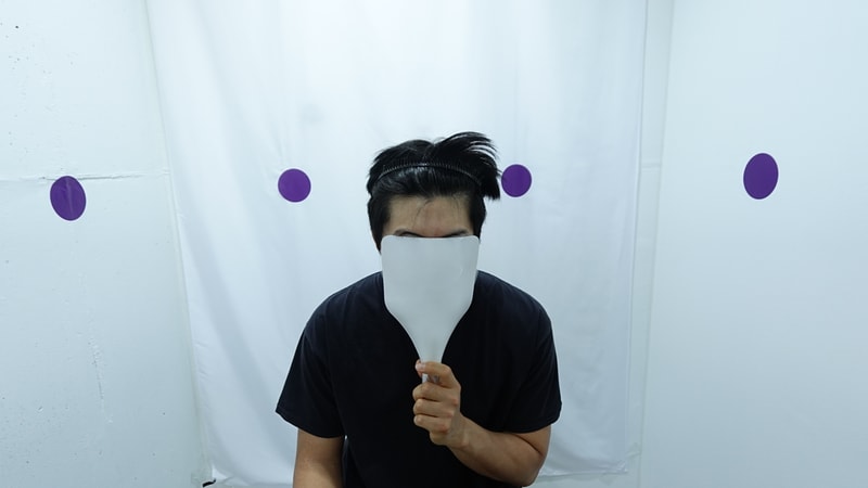자라다의원 모발이식 3개월차 후기입니다