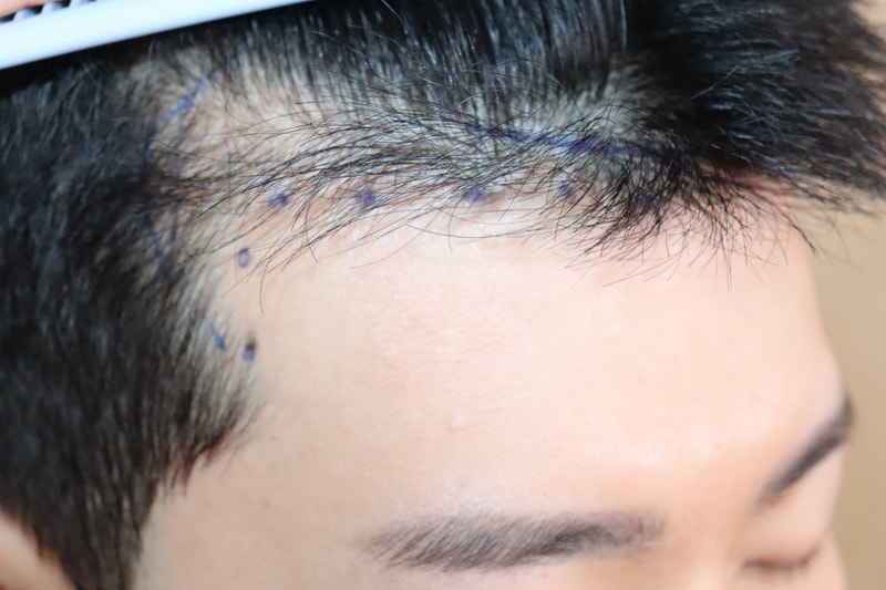 서울 움찬의원 만족도 최상