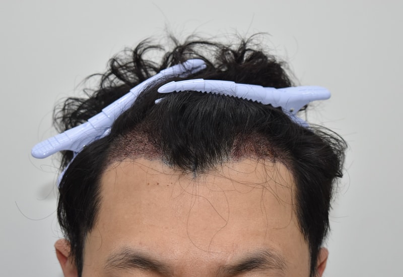 1b5a58222912febd2e722851138af33b_1777898712_8578.JPG