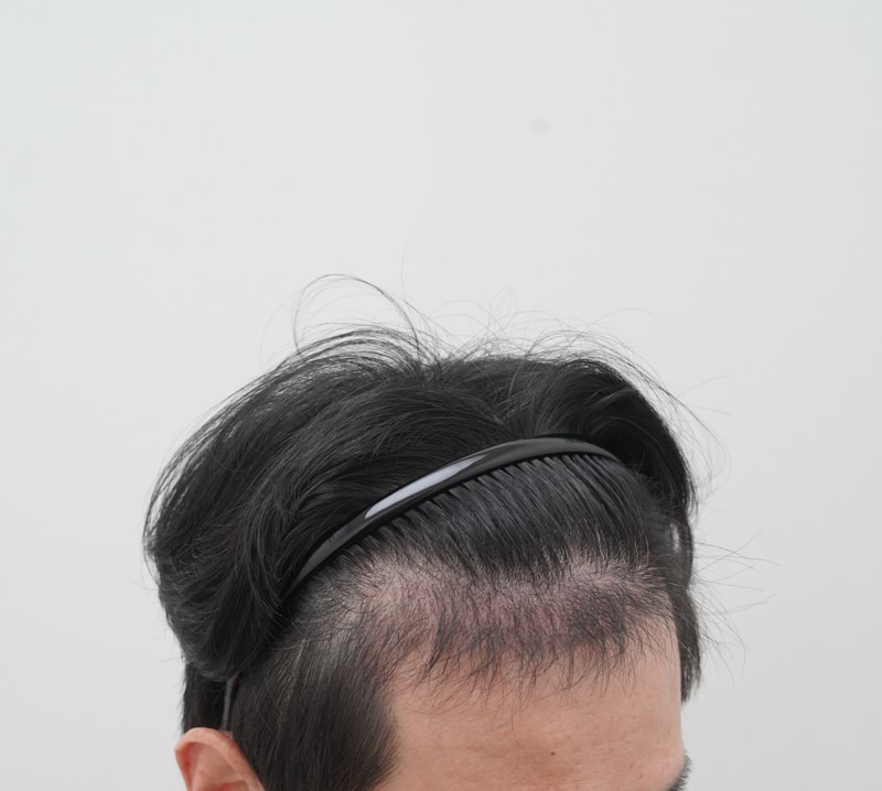 4dec72fce6212cfdbe783620f8fb9ecf_1779345619_3749.JPG