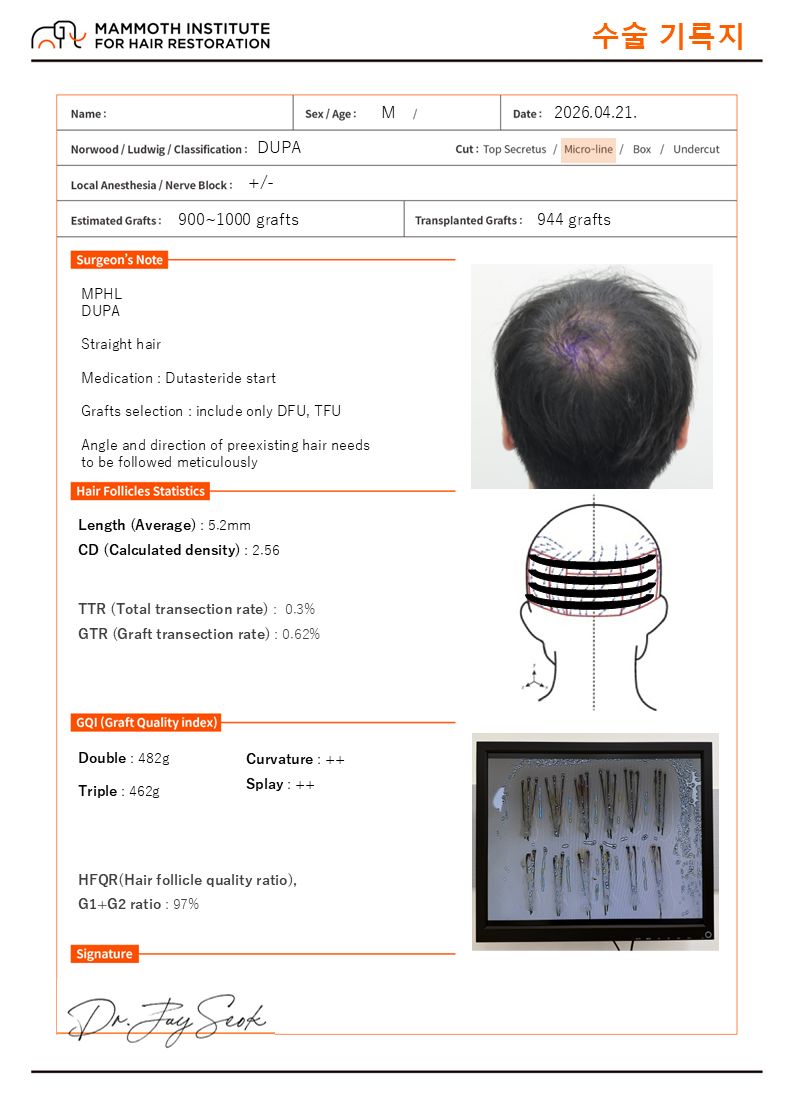 압구정 맘모스 비절개 사파이어 슬릿 모발이식 당일 후기