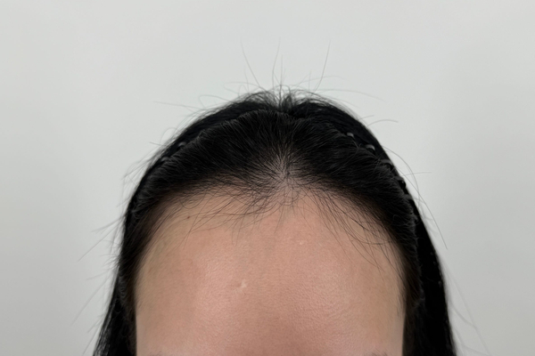 포토후기 이미지