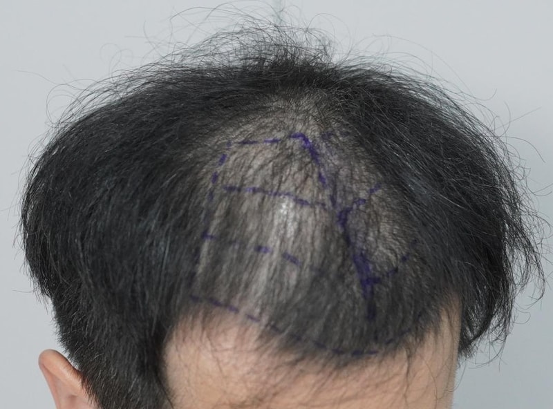 2d218f8f6b921faad20b13628315974b_1782358946_5182.jpg