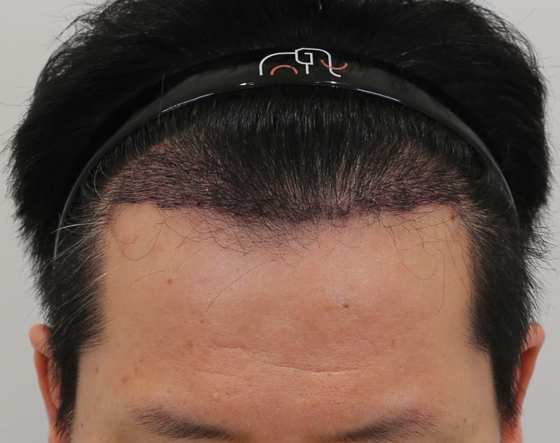 포토후기 이미지